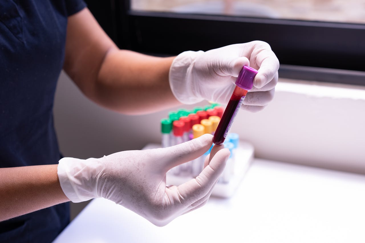 why-choose-us-01 Gloved hands carefully handling a blood sample in a medical or laboratory environment.